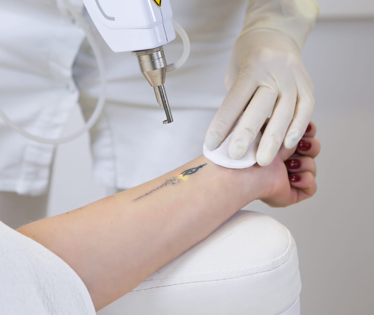 Zye Laser promete revolucionar a dermatologia Dra. Ingrid Telles